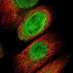 Immunofluorescent staining of human cell line A-431 shows localization to nucleoplasm, nuclear membrane & cytosol.