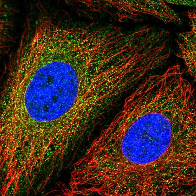 Anti-MCM3AP Antibody