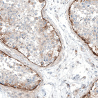 Anti-LAMA1 Antibody