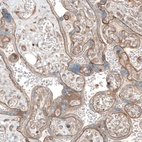 Immunohistochemical staining of human placenta shows membranous positivity in trophoblastic cells.