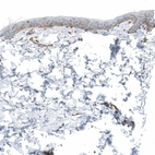 Immunohistochemical staining of human skin shows membranous positivity in stratum basale.