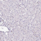 Immunohistochemical staining of human liver shows low expression as expected.