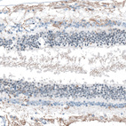 Anti-FAM161A Antibody