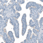 Immunohistochemical staining of human Fallopian tube shows moderate positivity in cilium basal body in glandular cells.