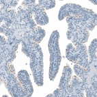 Immunohistochemical staining of human Fallopian tube shows moderate positivity in cilium basal body in glandular cells.