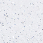 Immunohistochemical staining of human cerebral cortex shows no positivity in neurons as expected.