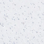 Immunohistochemical staining of human cerebral cortex shows no positivity in neurons as expected.