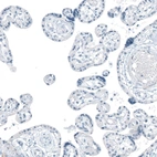 Immunohistochemical staining of human placenta shows no positivity in trophoblastic cells as expected.