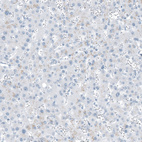 Anti-FAM161A Antibody