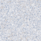 Immunohistochemical staining of human liver shows no positivity in hepatocytes as expected.