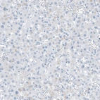 Immunohistochemical staining of human liver shows no positivity in hepatocytes as expected.