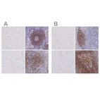 Immunohistochemical staining of human cerebral cortex, lymph node, skeletal muscle and tonsil using Anti-CD37 antibody HPA032120 (A) shows similar protein distribution across tissues to independent antibody HPA032121 (B).