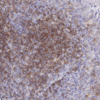 Immunohistochemical staining of human tonsil shows strong membranous positivity in non-germinal center cells.