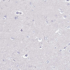 Immunohistochemical staining of human cerebral cortex shows no positivity in neurons as expected.