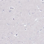 Immunohistochemical staining of human cerebral cortex shows no positivity in neurons as expected.