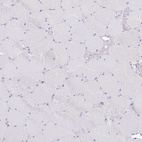 Immunohistochemical staining of human skeletal muscle shows no positivity in myocytes as expected.