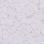 Immunohistochemical staining of human skeletal muscle shows no positivity in myocytes as expected.