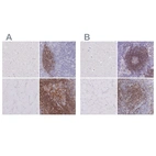 Immunohistochemical staining of human cerebral cortex, lymph node, skeletal muscle and tonsil using Anti-CD37 antibody HPA032121 (A) shows similar protein distribution across tissues to independent antibody HPA032120 (B).