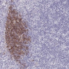 Immunohistochemical staining of human lymph node shows strong membranous positivity in non-germinal center cells.