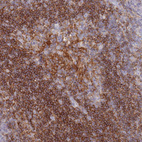 Immunohistochemical staining of human tonsil shows strong membranous positivity in non-germinal center cells.