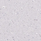 Immunohistochemical staining of human cerebral cortex shows no positivity in neurons as expected.