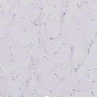 Immunohistochemical staining of human skeletal muscle shows no positivity in myocytes as expected.