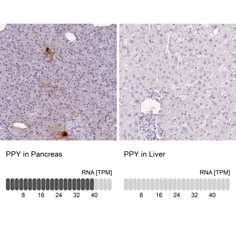 Anti-PPY Antibody