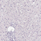 Immunohistochemical staining of human liver shows no extracellular space positivity in hepatocytes as expected.