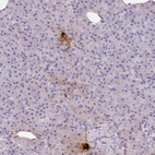 Immunohistochemical staining of human pancreas shows strong extracellular space positivity in islets of Langerhans.