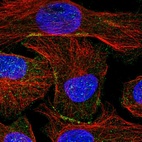 Immunofluorescent staining of human cell line U-2 OS shows localization to plasma membrane.