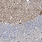 Anti-SHANK1 Antibody