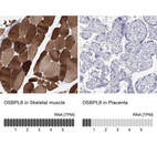 Anti-OSBPL6 Antibody