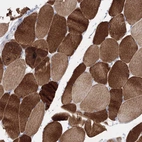 Immunohistochemical staining of human skeletal muscle shows strong cytoplasmic positivity in myocytes.
