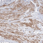 Immunohistochemical staining of human prostate shows moderate cytoplasmic positivity in smooth muscle cells.