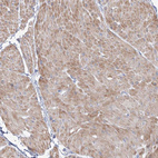 Anti-OSBPL6 Antibody