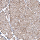 Immunohistochemical staining of human smooth muscle shows moderate cytoplasmic positivity in smooth muscle cells.
