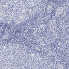Anti-OSBPL6 Antibody