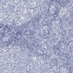 Immunohistochemical staining of human tonsil shows no positivity in non-germinal center cells as expected.