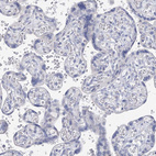 Anti-OSBPL6 Antibody