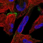 Immunofluorescent staining of human cell line RH-30 shows localization to plasma membrane.
