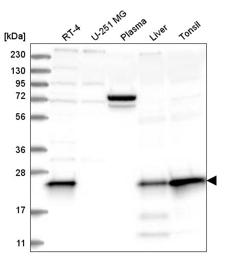 Anti-MGMT Antibody