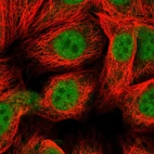 Immunofluorescent staining of human cell line MCF7 shows localization to nucleoplasm.