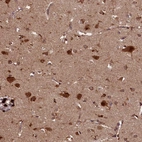 Anti-SLC11A2 Antibody