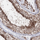 Immunohistochemical staining of human testis shows high expression.