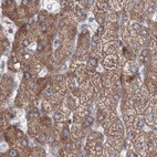 Immunohistochemical staining of human liver using Anti-PEX13 antibody HPA032141.