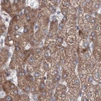 Immunohistochemical staining of human liver using Anti-PEX13 antibody HPA032141.