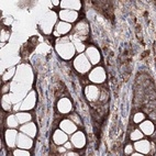 Immunohistochemical staining of human colon using Anti-PEX13 antibody HPA032141.
