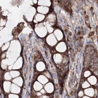 Immunohistochemical staining of human colon using Anti-PEX13 antibody HPA032141.