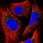 Immunofluorescent staining of human cell line U-2 OS shows localization to vesicles.