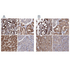 Immunohistochemical staining of human colon, kidney, liver and pancreas using Anti-PEX13 antibody HPA032142 (A) shows similar protein distribution across tissues to independent antibody HPA032141 (B).